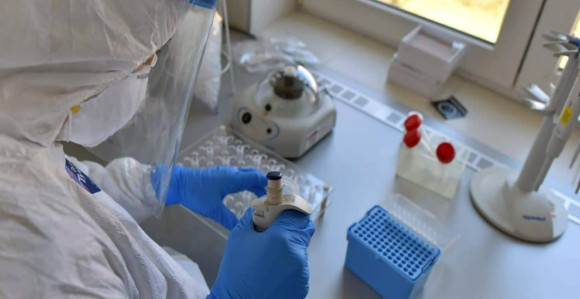 Još 100 zaraženih osoba u Srbiji virusom korona