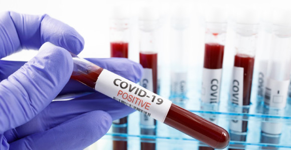 U Srbiji novih 86 zaraženih, dvije osobe preminule