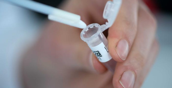 Evo kako izgleda testiranje na virus korona