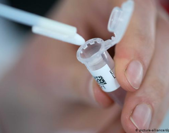 Evo kako izgleda testiranje na virus korona
