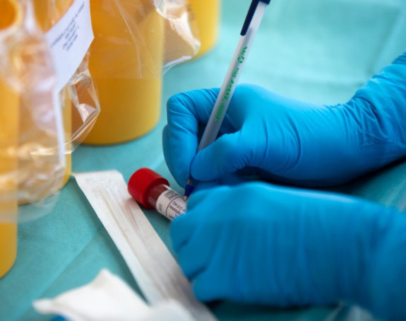 Srpska: Na virus korona pozitivno još 13 osoba