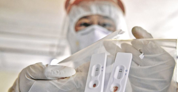 U Federaciji BiH još troje pozitivno na virus korona