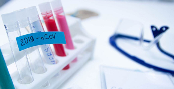 Potvrđeno koliko je ljudi u Hrvatskoj imalo virus korona