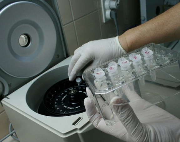 Srpska i dalje čeka na aparat za tipizaciju tkiva