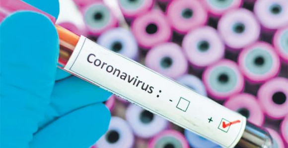 Kod još 16 osoba potvrđen virus korona u Srpskoj
