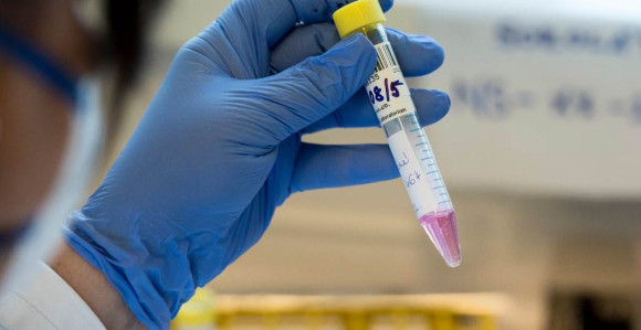 Srbija: Novih 69 slučajeva korone, nema preminulih