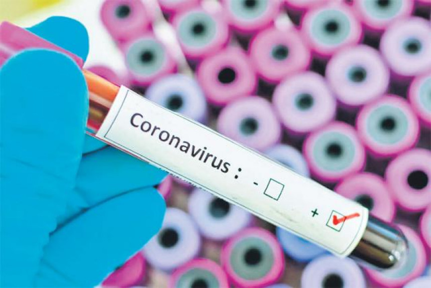 Novi slučaj virusa korona potvrdjen u Bijeljini
