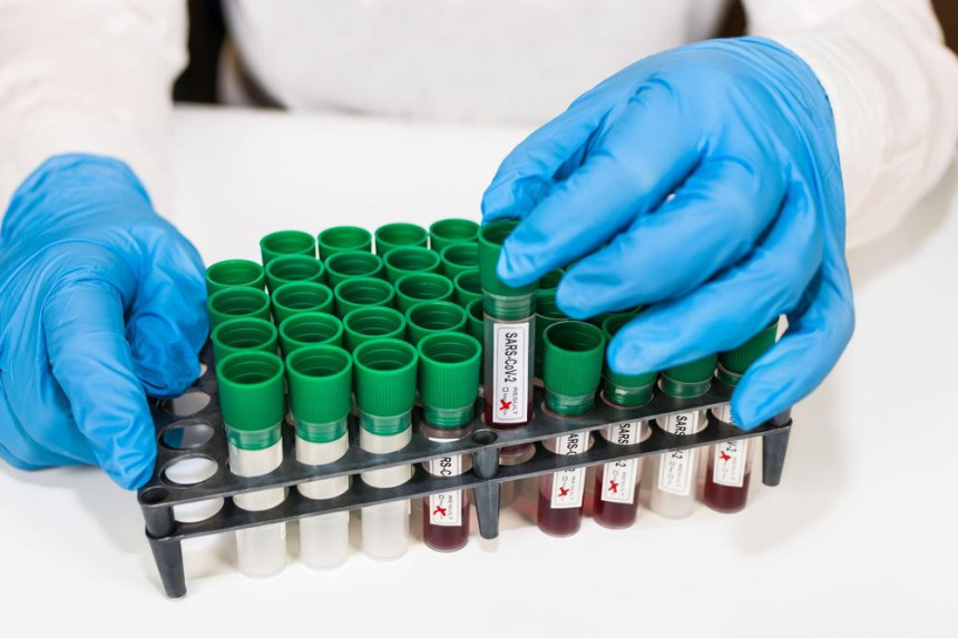 Nove mjere protiv virusa korona od danas u Srbiji