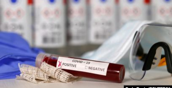 Broj zaraženih ne pada: U Srbiji 71 novi slučaj korone