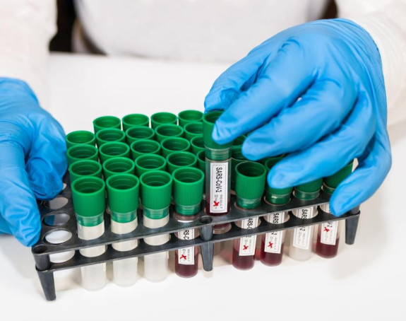 Nove mjere protiv virusa korona od danas u Srbiji