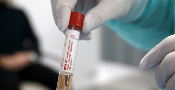 FBiH: U protekla 24 časa zaražene još 24 osobe