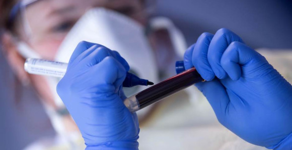 Broj zaraženih koronom u svijetu prešao 8,4 miliona