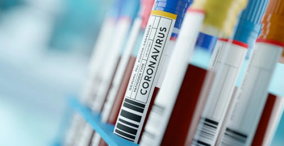 U FBiH 42 nova slučaja zaraze virusom korona