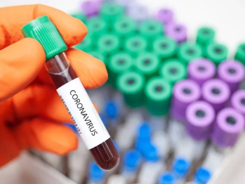 Dnevni rekord: 60 ili 16% od testiranih zaraženih virusom korona u Republici Srpskoj