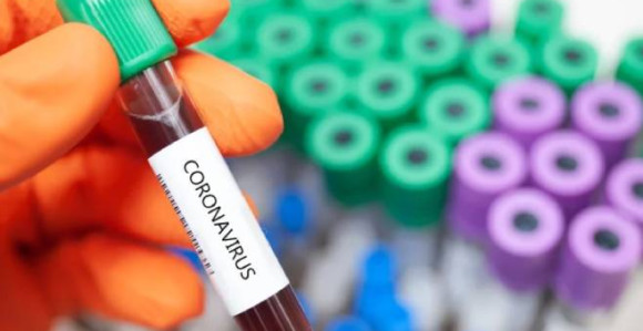 Dnevni rekord: 60 ili 16% od testiranih zaraženih virusom korona u Republici Srpskoj