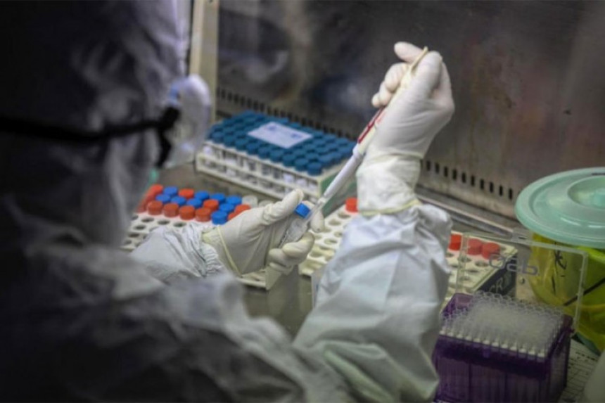 U Federaciji BiH nova 22 slučaja virusa korona