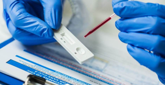 У Србији се продају негативни фалсификовани тестови?!