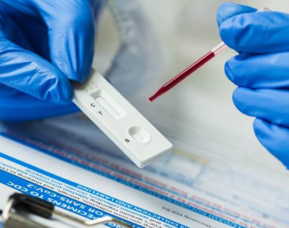 U Srbiji se prodaju negativni falsifikovani testovi?!