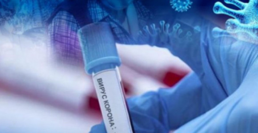 U RS još 62 osobe zaražene ili 16,5% od broja testiranih