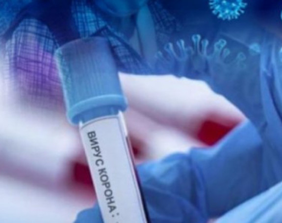 U RS još 62 osobe zaražene ili 16,5% od broja testiranih