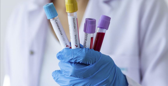 U Srpskoj pozitivna još 31 osoba na virus korona, što je 15% od broja testiranih