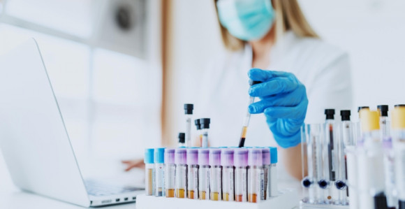 Amerikanci testirali 10% stanovništva ili 32,5 miliona ljudi