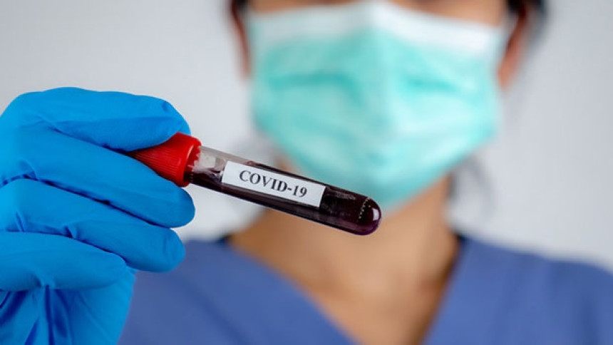 У ФБиХ још 38 нових случајева заразе вирусом корона