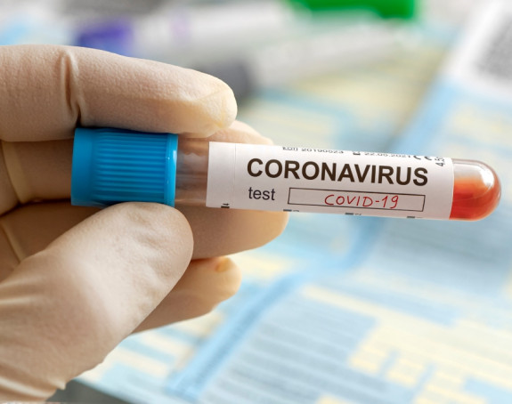 U FBiH još 69 slučajeva, 9% od broja testiranih