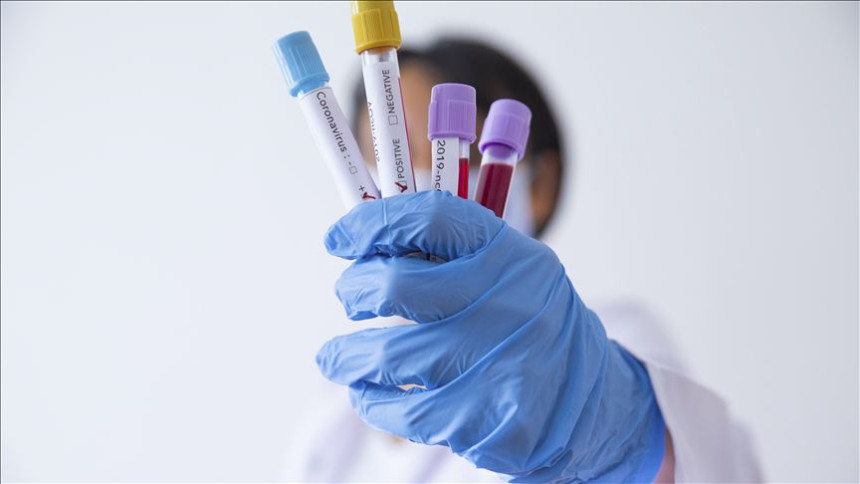 Potvrđena 42 nova slučaja korone u Srpskoj, 10% od broja testiranih