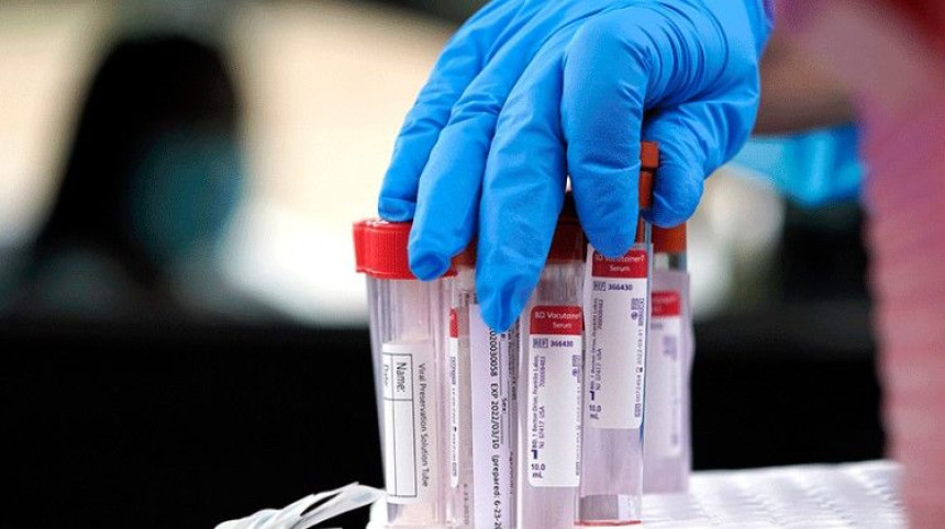 U FBiH pozitivno na virus korona još 29 osoba