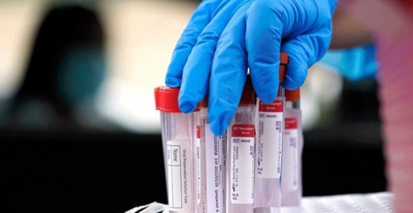 Virus korona potvrđen kod još 58 osoba u Srpskoj