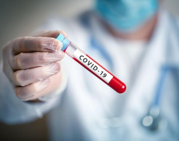 Od 1.447 uzoraka u FBiH zaražene su još 122 osobe