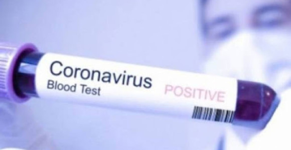 U Federaciji BiH od testiranih 688 pozitivno 46