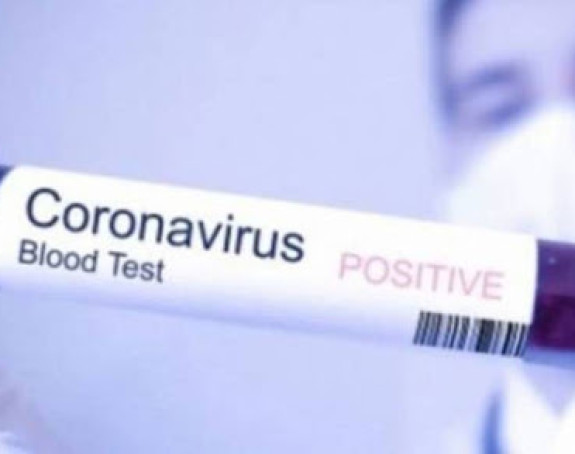 U Srpskoj zaraženo još 83 osoba, najviše iz Bijeljine