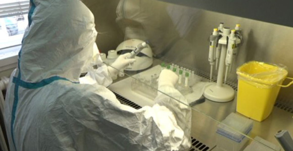 Laboratorijama u Zenici i Tešnju nedostaje testova