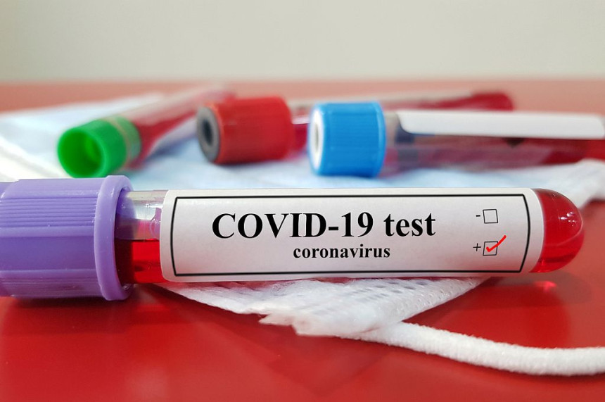 U Crnoj Gori registrovano 87 novih slučajeva korone