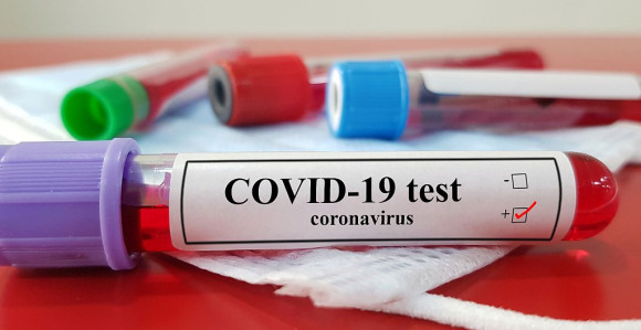 U Crnoj Gori registrovano 87 novih slučajeva korone