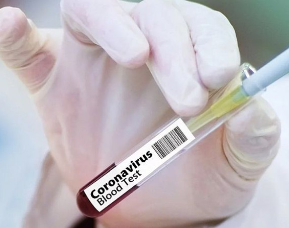 U FBiH zaražena još 71 osoba, tri preminule