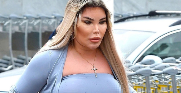 Ljudski Ken postao Barbi imao preko 200 operacija!