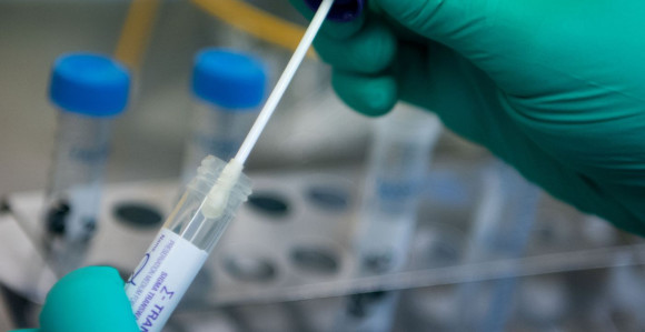 U Federaciji BiH na kovid-19 pozitivno još 137 osoba