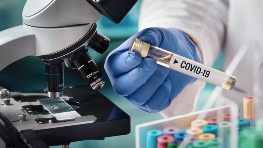 Научници развијају нови тест на вирус корона