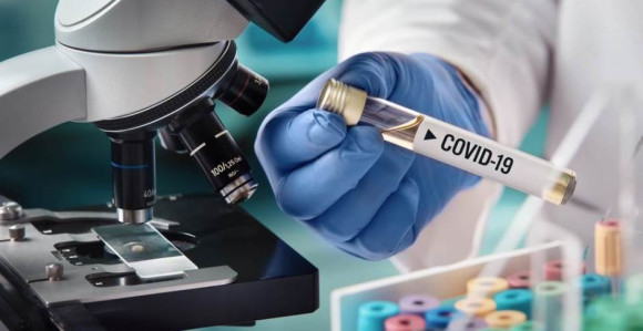 Naučnici razvijaju novi test na virus korona
