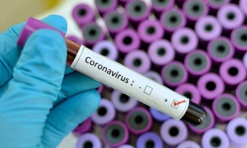 U Brčkom još devet osoba zaraženo virusom korona