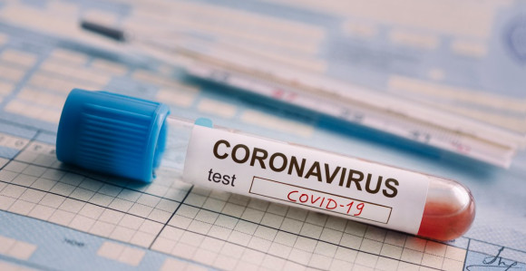 Srbija: Preminulo 11 osoba, virusom zaraženo još 396