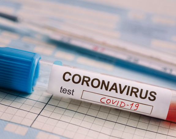 Srbija: Preminulo 11 osoba, virusom zaraženo još 396
