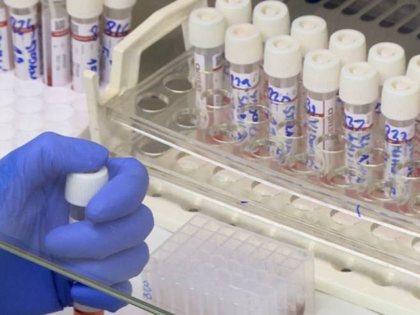 U FBiH 74 nova slučaja, najviše u Sarajevu