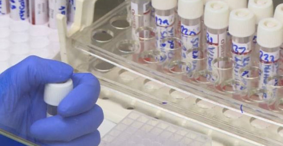 U FBiH 74 nova slučaja, najviše u Sarajevu