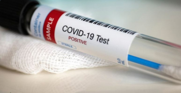 Лажни тестови на корону, полиција нема приступ базама