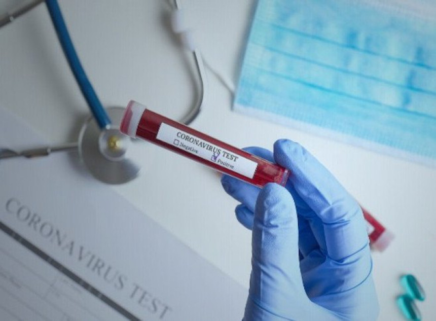 U FBiH 197 novozaraženih virusom korona