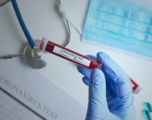 U FBiH 197 novozaraženih virusom korona